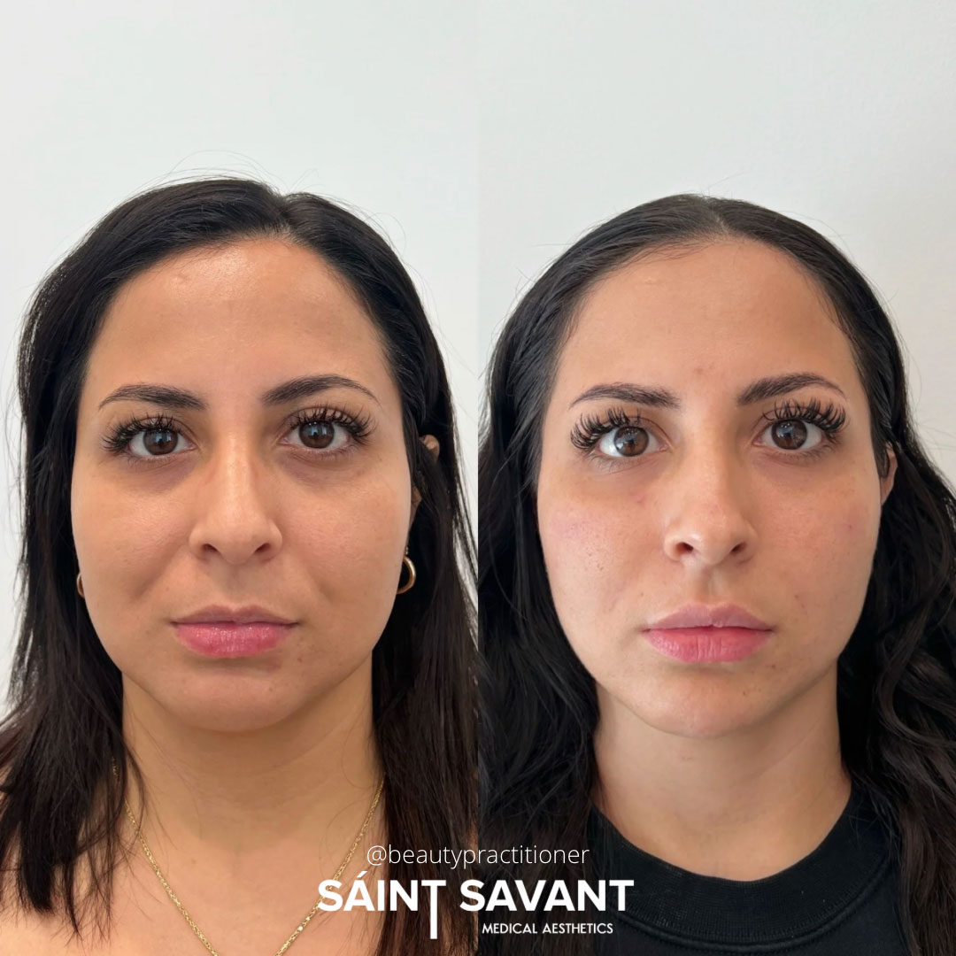 full-face-under-eye-1a