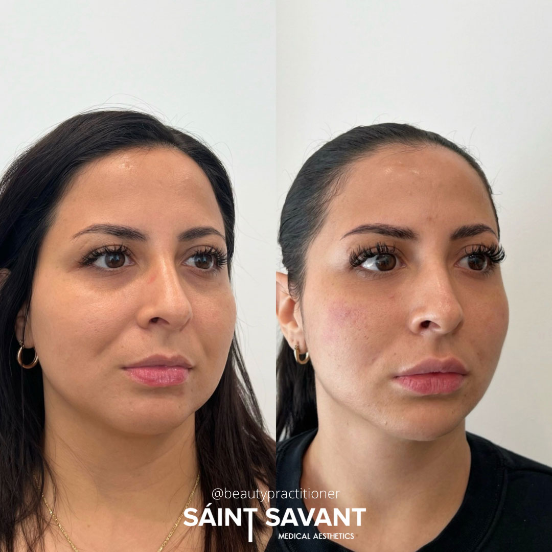 full-face-under-eye-1c